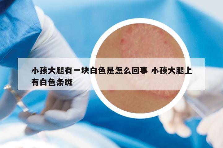 小孩大腿有一块白色是怎么回事 小孩大腿上有白色条斑