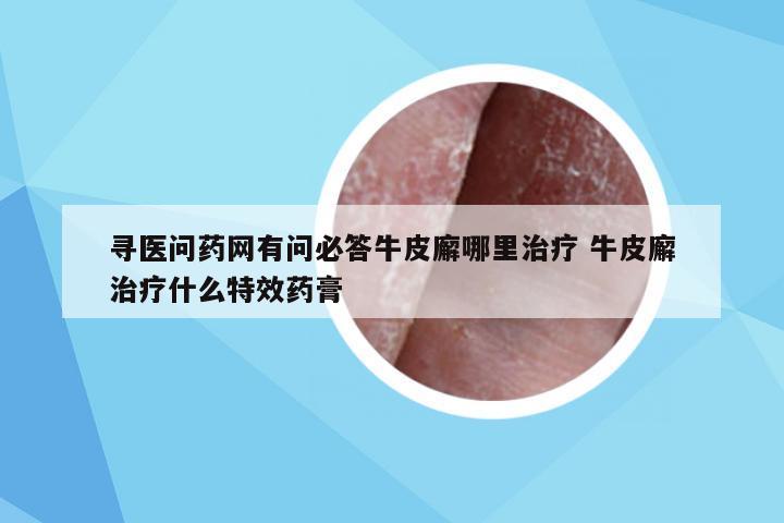 寻医问药网有问必答牛皮廨哪里治疗 牛皮廨治疗什么特效药膏