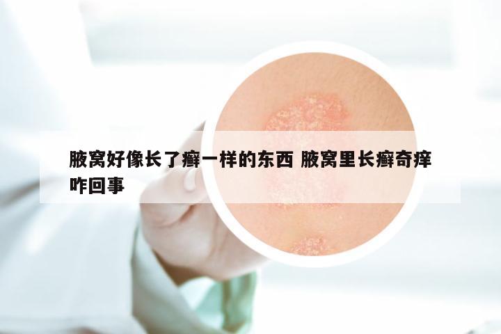 腋窝好像长了癣一样的东西 腋窝里长癣奇痒咋回事