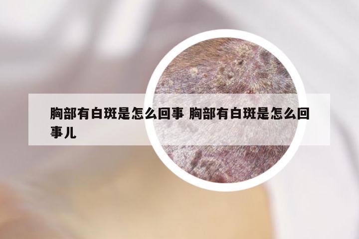 胸部有白斑是怎么回事 胸部有白斑是怎么回事儿