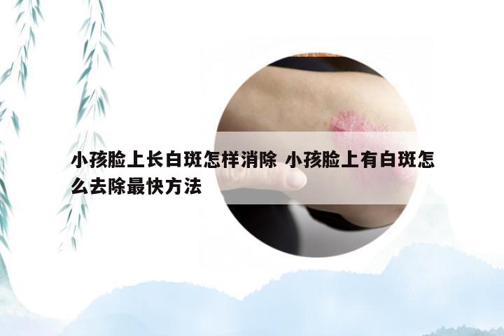 小孩脸上长白斑怎样消除 小孩脸上有白斑怎么去除最快方法