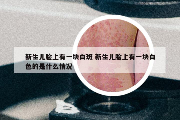 新生儿脸上有一块白斑 新生儿脸上有一块白色的是什么情况