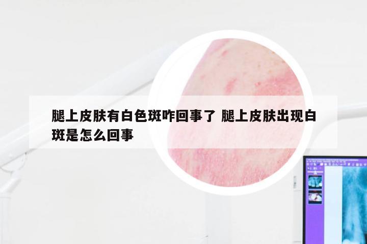 腿上皮肤有白色斑咋回事了 腿上皮肤出现白斑是怎么回事