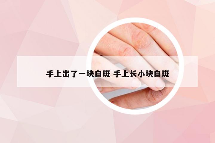 手上出了一块白斑 手上长小块白斑