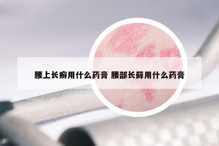 腰上长癣用什么药膏 腰部长藓用什么药膏