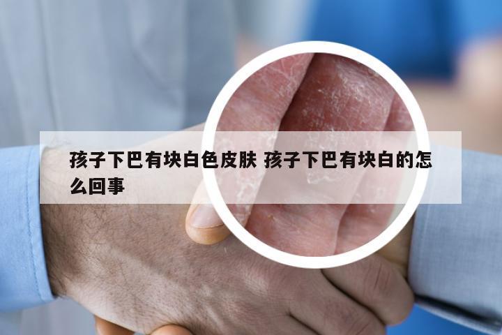 孩子下巴有块白色皮肤 孩子下巴有块白的怎么回事