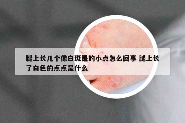 腿上长几个像白斑是的小点怎么回事 腿上长了白色的点点是什么