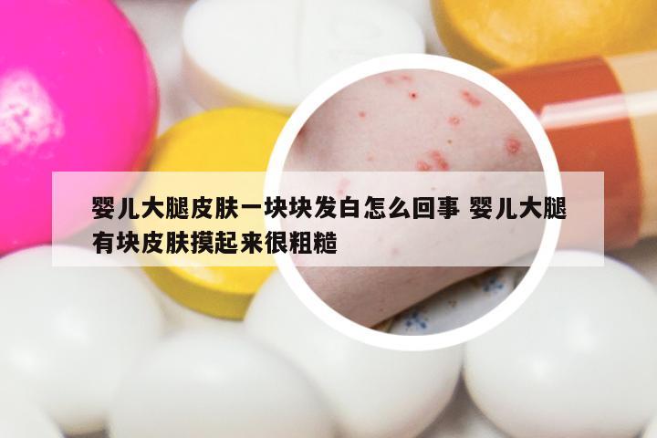 婴儿大腿皮肤一块块发白怎么回事 婴儿大腿有块皮肤摸起来很粗糙