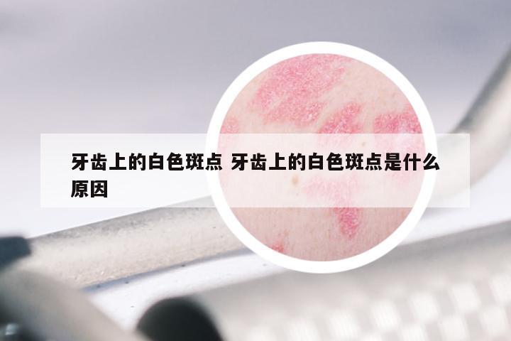 牙齿上的白色斑点 牙齿上的白色斑点是什么原因