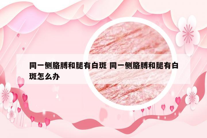 同一侧胳膊和腿有白斑 同一侧胳膊和腿有白斑怎么办