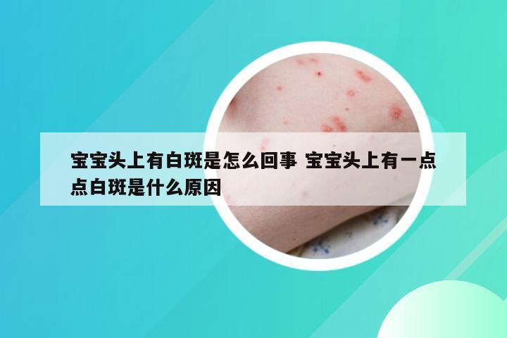 宝宝头上有白斑是怎么回事 宝宝头上有一点点白斑是什么原因