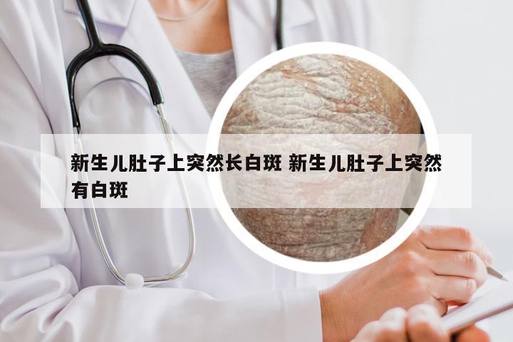 新生儿肚子上突然长白斑 新生儿肚子上突然有白斑