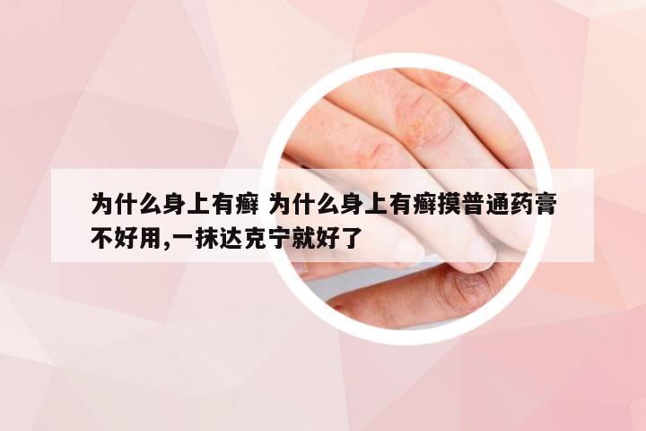 为什么身上有癣 为什么身上有癣摸普通药膏不好用,一抹达克宁就好了