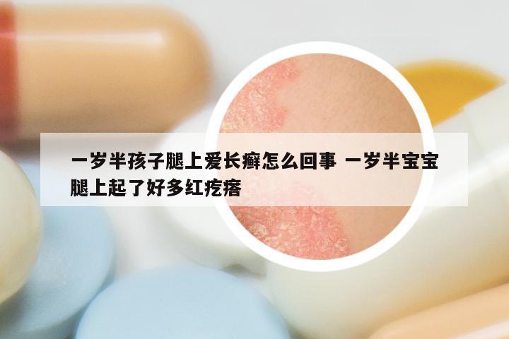 一岁半孩子腿上爱长癣怎么回事 一岁半宝宝腿上起了好多红疙瘩