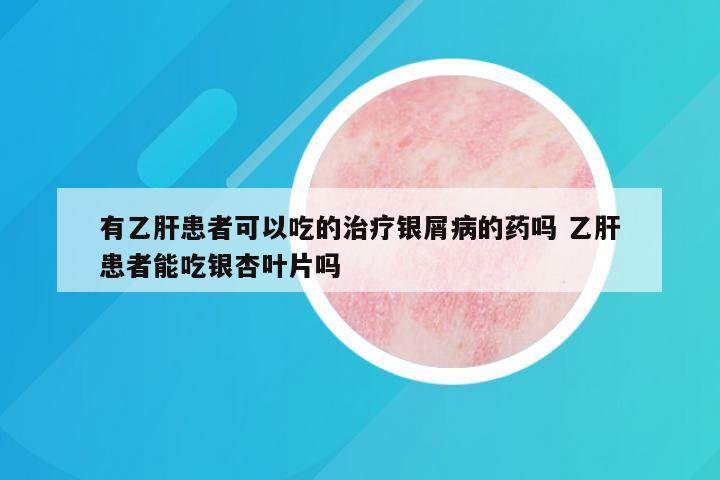 有乙肝患者可以吃的治疗银屑病的药吗 乙肝患者能吃银杏叶片吗