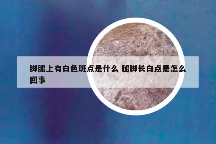 脚腿上有白色斑点是什么 腿脚长白点是怎么回事