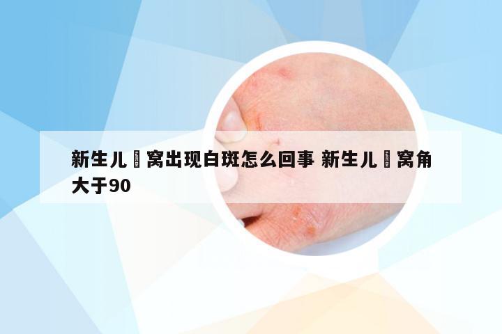 新生儿腘窝出现白斑怎么回事 新生儿腘窝角大于90