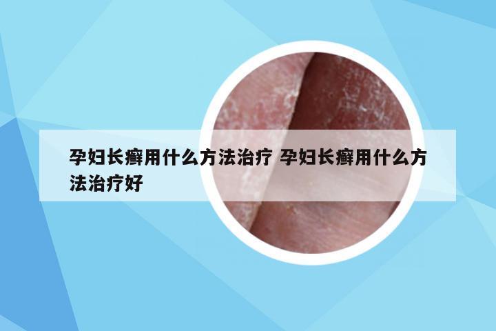 孕妇长癣用什么方法治疗 孕妇长癣用什么方法治疗好