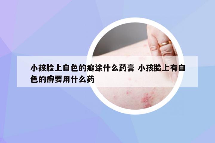 小孩脸上白色的癣涂什么药膏 小孩脸上有白色的癣要用什么药