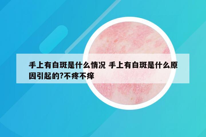 手上有白斑是什么情况 手上有白斑是什么原因引起的?不疼不痒