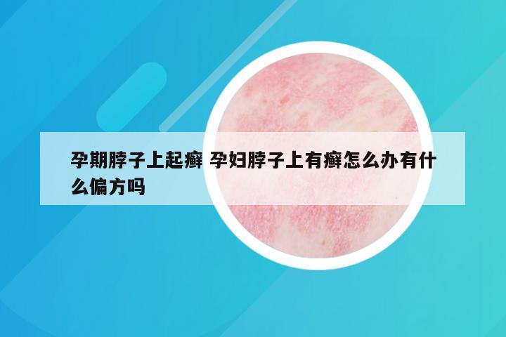 孕期脖子上起癣 孕妇脖子上有癣怎么办有什么偏方吗