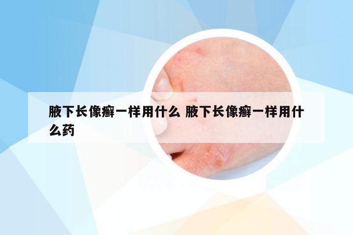 腋下长像癣一样用什么 腋下长像癣一样用什么药