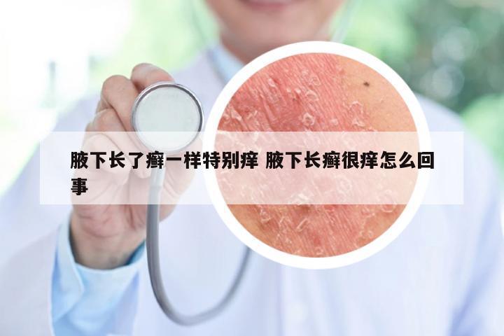 腋下长了癣一样特别痒 腋下长癣很痒怎么回事