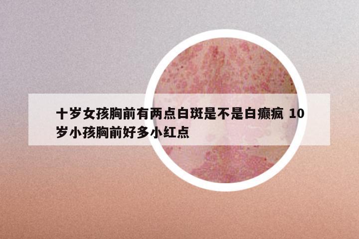 十岁女孩胸前有两点白斑是不是白癫疯 10岁小孩胸前好多小红点