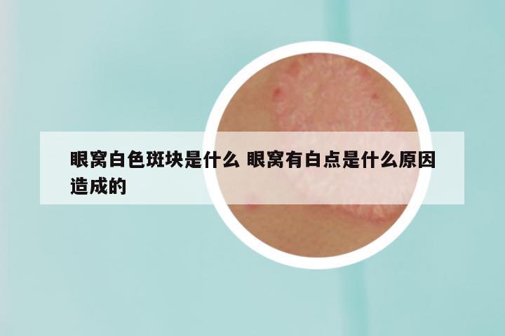 眼窝白色斑块是什么 眼窝有白点是什么原因造成的