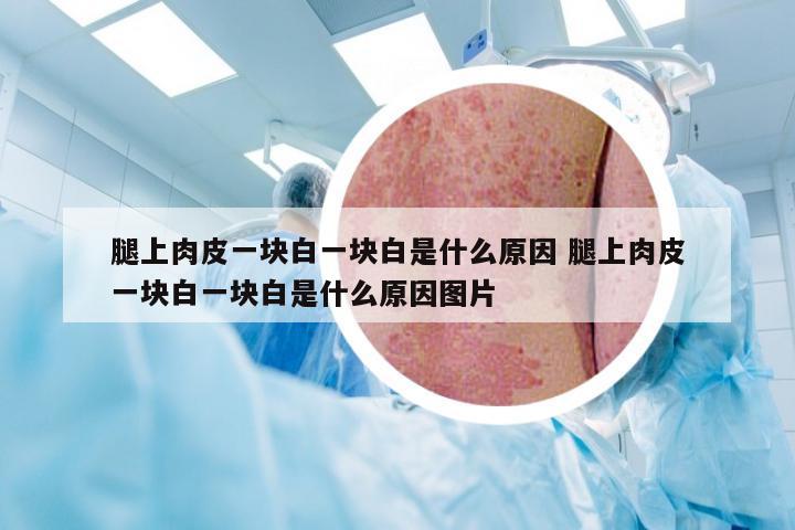 腿上肉皮一块白一块白是什么原因 腿上肉皮一块白一块白是什么原因图片