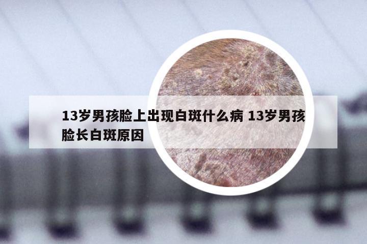 13岁男孩脸上出现白斑什么病 13岁男孩脸长白斑原因