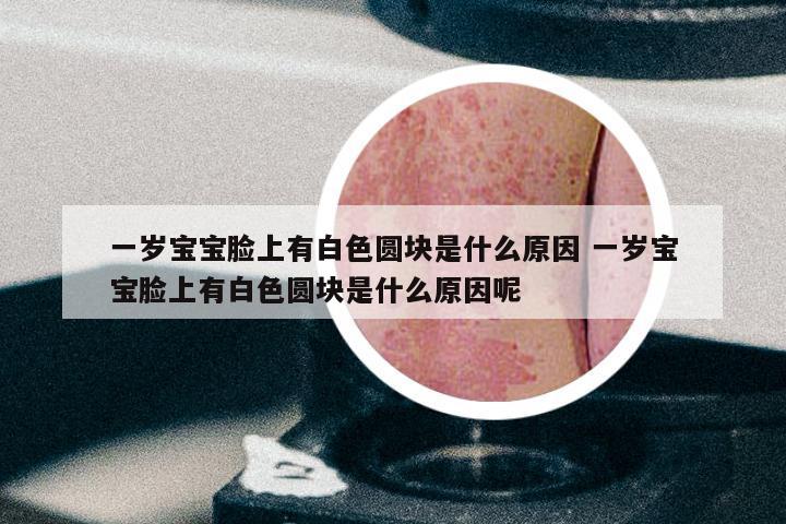 一岁宝宝脸上有白色圆块是什么原因 一岁宝宝脸上有白色圆块是什么原因呢