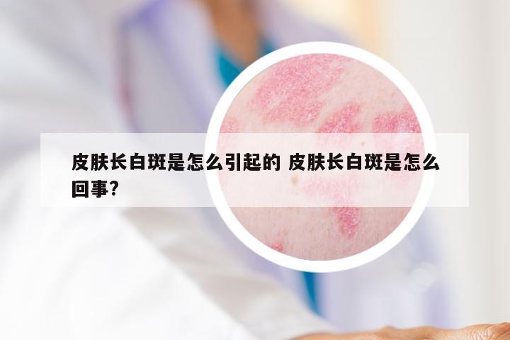 皮肤长白斑是怎么引起的 皮肤长白斑是怎么回事?