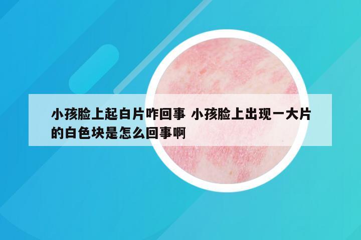 小孩脸上起白片咋回事 小孩脸上出现一大片的白色块是怎么回事啊