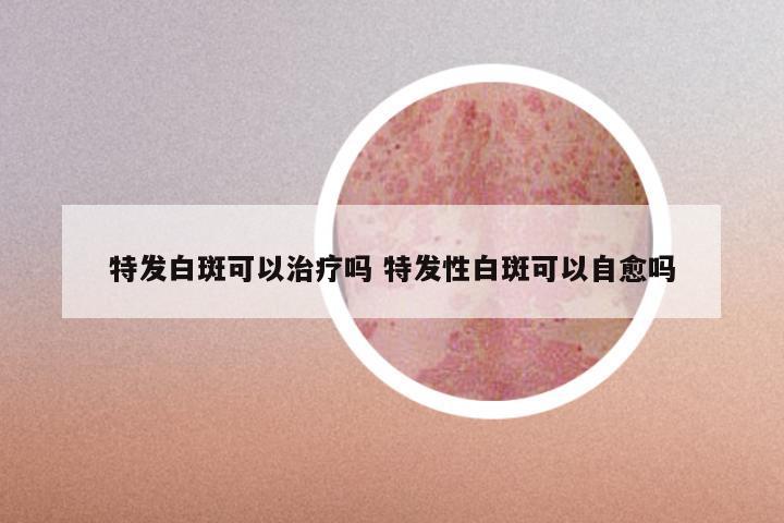 特发白斑可以治疗吗 特发性白斑可以自愈吗