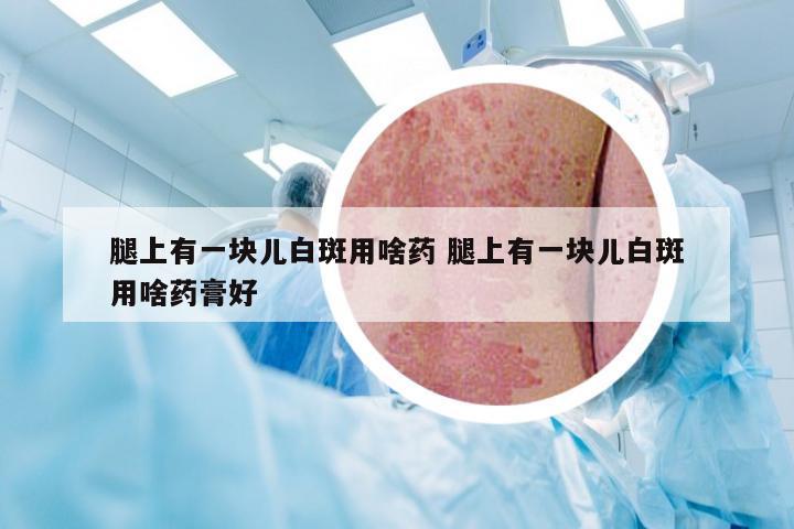 腿上有一块儿白斑用啥药 腿上有一块儿白斑用啥药膏好