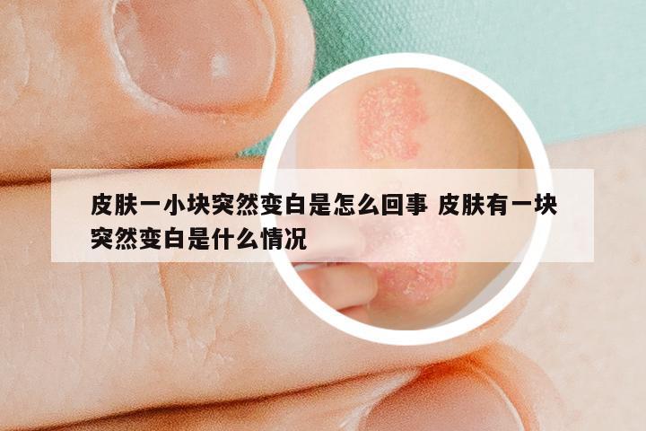 皮肤一小块突然变白是怎么回事 皮肤有一块突然变白是什么情况