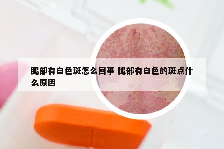 腿部有白色斑怎么回事 腿部有白色的斑点什么原因