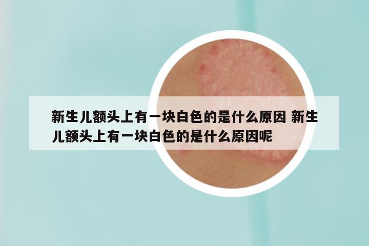 新生儿额头上有一块白色的是什么原因 新生儿额头上有一块白色的是什么原因呢