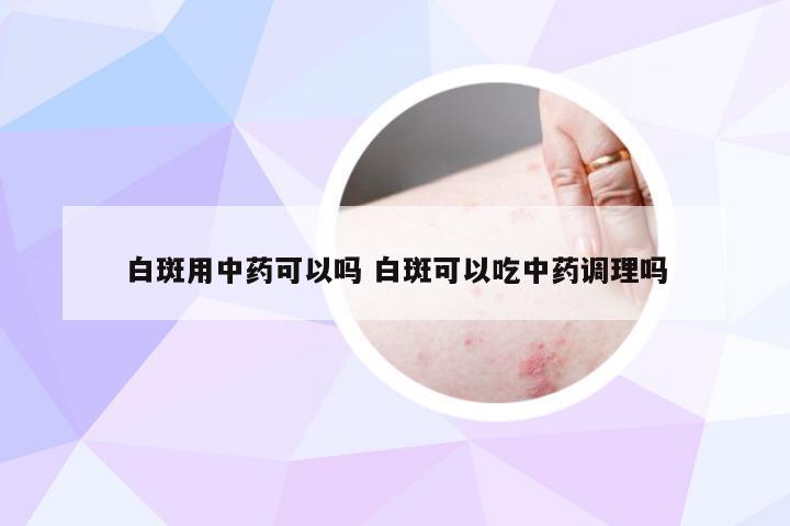 白斑用中药可以吗 白斑可以吃中药调理吗