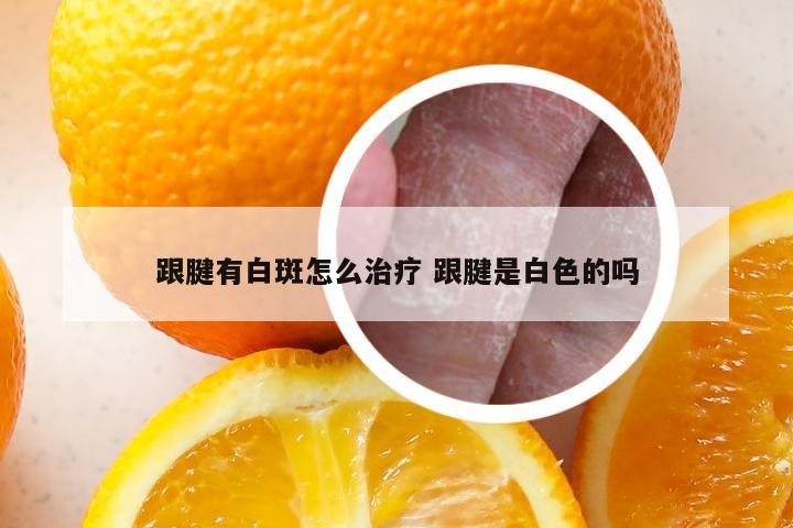 跟腱有白斑怎么治疗 跟腱是白色的吗