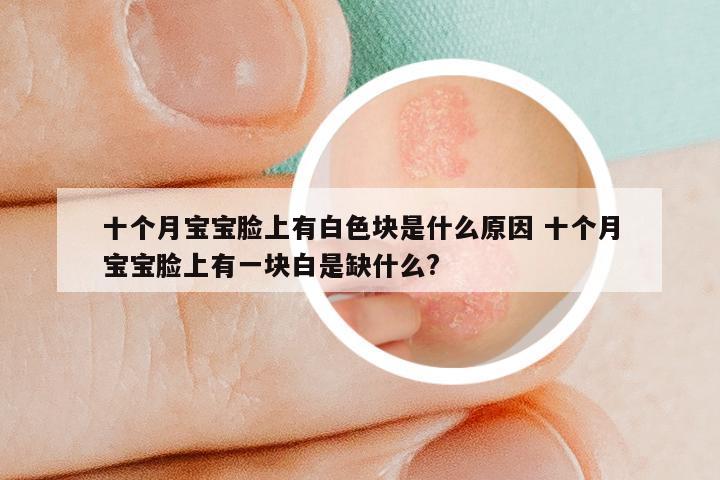 十个月宝宝脸上有白色块是什么原因 十个月宝宝脸上有一块白是缺什么?