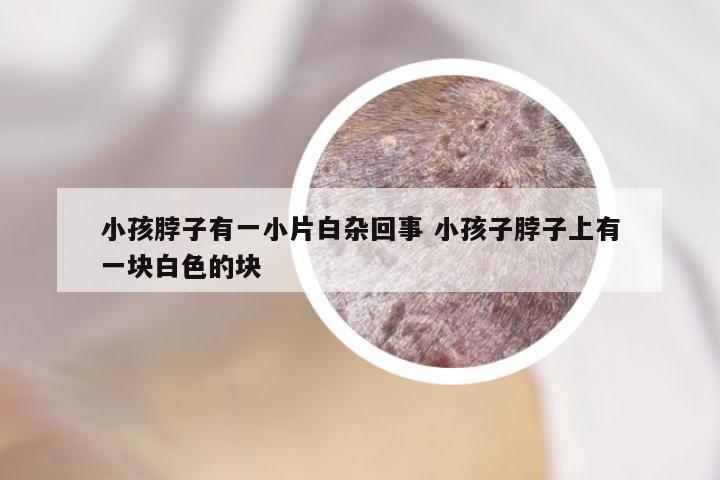 小孩脖子有一小片白杂回事 小孩子脖子上有一块白色的块