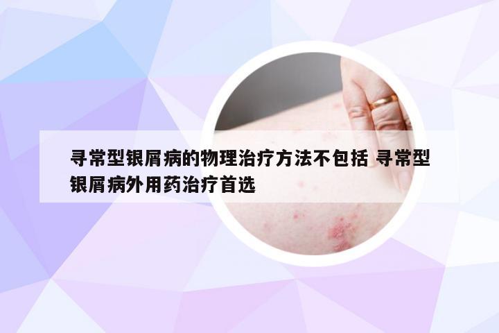 寻常型银屑病的物理治疗方法不包括 寻常型银屑病外用药治疗首选