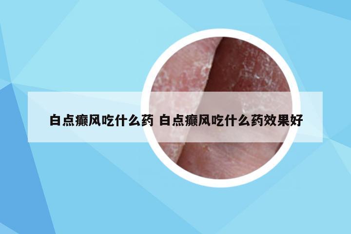 白点癫风吃什么药 白点癫风吃什么药效果好