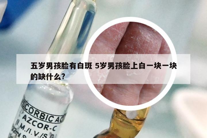 五岁男孩脸有白斑 5岁男孩脸上白一块一块的缺什么?