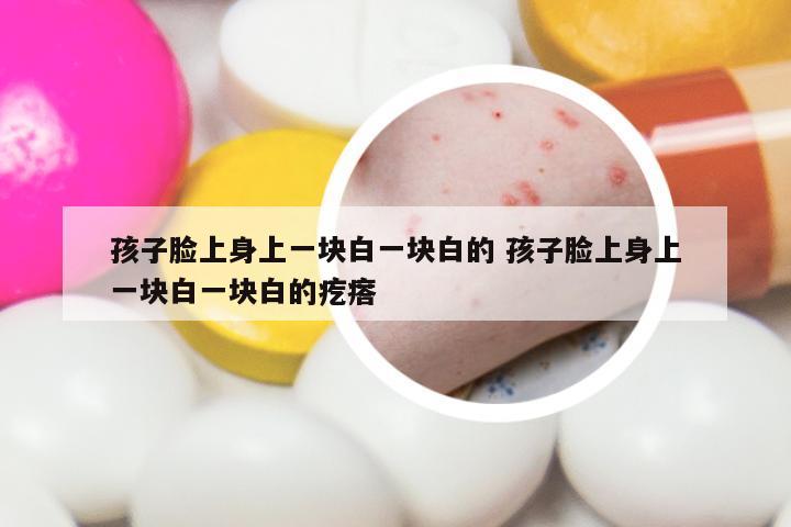 孩子脸上身上一块白一块白的 孩子脸上身上一块白一块白的疙瘩