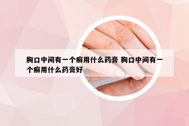 胸口中间有一个癣用什么药膏 胸口中间有一个癣用什么药膏好