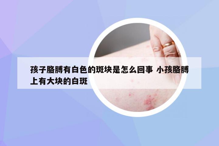 孩子胳膊有白色的斑块是怎么回事 小孩胳膊上有大块的白斑