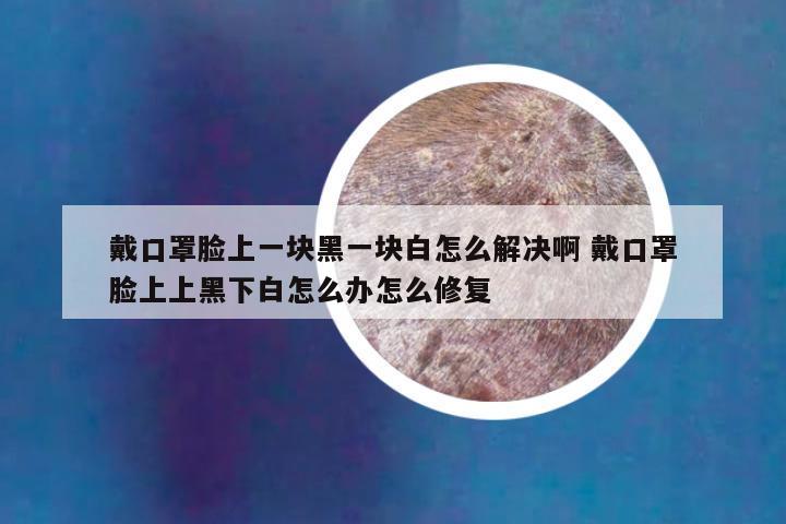 戴口罩脸上一块黑一块白怎么解决啊 戴口罩脸上上黑下白怎么办怎么修复